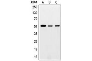 Western blot analysis of SMAD5 expression in HeLa (A), mouse testis (B), PC12 (C) whole cell lysates.