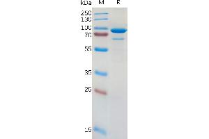 Human CD73 Protein, hFc Tag on SDS-PAGE under reducing condition.