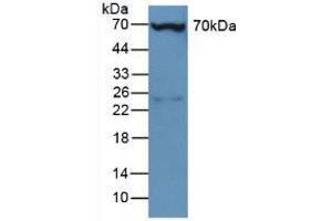 Figure. (Plastin 3 anticorps  (AA 5-251))
