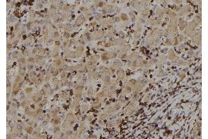 ABIN6273388 at 1/100 staining Human liver tissue by IHC-P. (RIOK2 anticorps  (Internal Region))