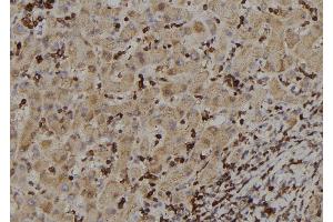 ABIN6273388 at 1/100 staining Human liver tissue by IHC-P. (RIOK2 anticorps  (Internal Region))