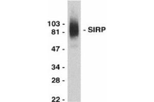 Western blot analysis of SIRP alpha in THP-1 whole cell lysate with this product at 0. (SIRPA anticorps  (C-Term))