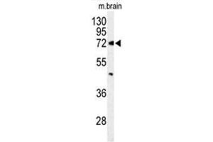 Western blot analysis of ABCD2 Antibody (Center) in mouse brain tissue lysates (35 µg/lane).
