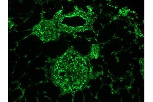 Image no. 3 for anti-Vimentin (VIM) antibody (ABIN335382)