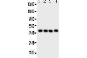 Western Blotting (WB) image for anti-CD34 (CD34) (AA 151-385) antibody (ABIN3043391) (CD34 anticorps  (AA 151-385))