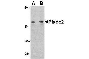 Image no. 1 for anti-Plexin Domain Containing 2 (PLXDC2) (C-Term) antibody (ABIN1492166) (PLXDC2 anticorps  (C-Term))