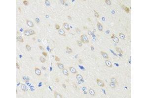 Immunohistochemistry of paraffin-embedded Rat brain using CRABP2 Polyclonal Antibody at dilution of 1:100 (40x lens). (CRABP2 anticorps)