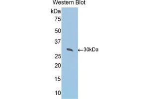 Western blot analysis of the recombinant protein. (Peroxiredoxin 4 anticorps  (AA 14-258))