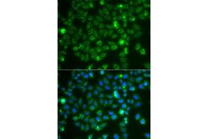 Immunofluorescence analysis of A549 cells using RAC1 antibody.