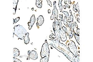 IHC analysis of CEBP Beta using anti-CEBP Beta antibody (ABIN3043809).