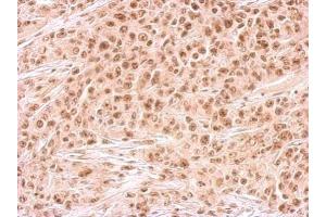 IHC-P Image Rad54B antibody detects RAD54B protein at on SAS xenograft by immunohistochemical analysis.