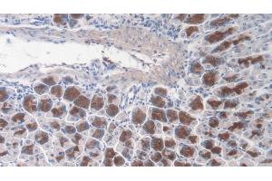Detection of TNC in Mouse Stomach Tissue using Polyclonal Antibody to Tenascin C (TNC) (TNC anticorps  (AA 174-621))