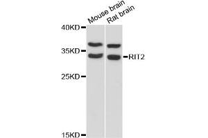 Western blot analysis of extracts of various cell lines, using RIT2 antibody (ABIN6292260) at 1:3000 dilution.