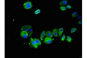 Immunofluorescent analysis of HepG2 cells using ABIN7170654 at dilution of 1:100 and Alexa Fluor 488-congugated AffiniPure Goat Anti-Rabbit IgG(H+L)