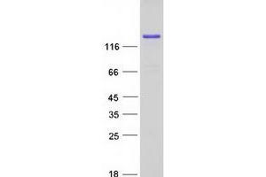 Validation with Western Blot