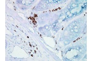 Immunohistochemistry analysis using Mouse Anti-Hsp70 Monoclonal Antibody, Clone BB70 . (HSP70/HSC70 anticorps  (FITC))
