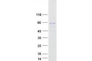 Validation with Western Blot