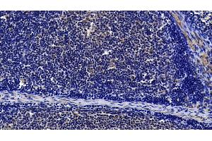 Detection of TLR3 in Porcine Lymph node Tissue using Polyclonal Antibody to Toll Like Receptor 3 (TLR3)
