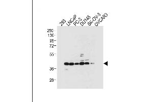 All lanes : Anti-STRA8 Antibody (C-term) at 1:2000 dilution Lane 1: 293 whole cell lysate Lane 2: LNCaP whole cell lysate Lane 3: PC-3 whole cell lysate Lane 4: D whole cell lysate Lane 5: SK-OV-3 whole cell lysate Lane 6: OVCAR3 whole cell lysate Lysates/proteins at 20 μg per lane. (STRA8 anticorps  (C-Term))