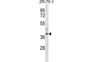 Western Blotting (WB) image for anti-Formyl Peptide Receptor 3 (FPR3) antibody (ABIN2997055)