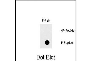 Dot blot analysis of Phospho-FAS- polyclonal antibody (ABIN389708 and ABIN2839663) on nitrocellulose membrane. (FAS anticorps  (pTyr291))