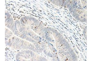 anti-Chemokine (C-X-C Motif) Ligand 5 (CXCL5) antibody