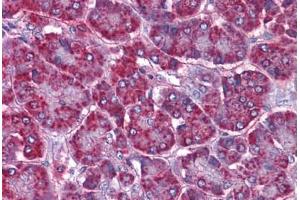 Human Pancreas: Formalin-Fixed, Paraffin-Embedded (FFPE) (SORBS1 anticorps  (AA 300-313))