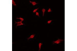 ABIN6275102 staining Hela by IF/ICC. (FBLN4 anticorps  (Internal Region))