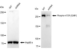 Western blotting analysis using Phospho-mTOR (S) antibody (ABIN7799349). (Recombinant MTOR anticorps  (pSer2481))