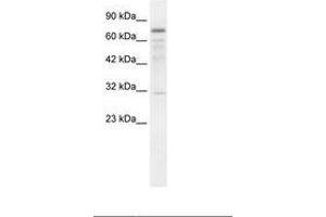 Image no. 1 for anti-tRNA Methyltransferase 1 (TRMT1) (AA 418-467) antibody (ABIN202857) (TRMT1 anticorps  (AA 418-467))