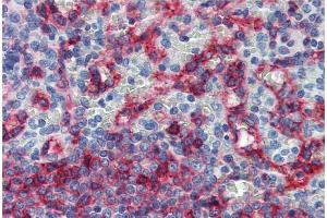 Immunohistochemistry staining of human spleen (paraffin sections) with anti-HLA-E (clone MEM-E/06).