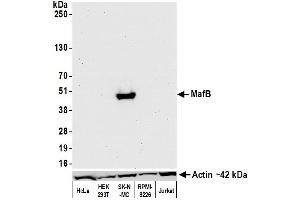 Western Blotting (WB) image for anti-Transcription Factor MafB (MAFB) (AA 1-50) antibody (ABIN7455090)