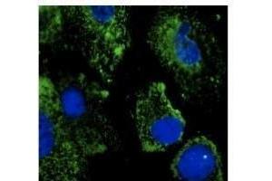 Anti-EEAI Ab at 1/500 dilution, Rabbit polyclonal to goat lµg (HRP) at 1/10,000 dilution,