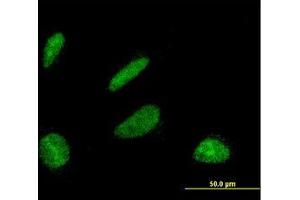 Image no. 2 for anti-DBF4 Homolog (DBF4) (AA 2-99) antibody (ABIN599157) (DBF4 anticorps  (AA 2-99))