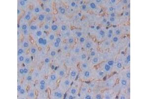 IHC-P analysis of Mouse Tissue, with DAB staining. (TREM1 anticorps  (AA 21-230))