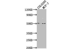 Western Blot Positive WB detected in: COLO205 whole cell lysate, MCF-7 whole cell lysate All lanes: LRAT antibody at 1:2000 Secondary Goat polyclonal to rabbit IgG at 1/50000 dilution Predicted band size: 26 kDa Observed band size: 50 kDa (LRAT anticorps  (AA 24-182))