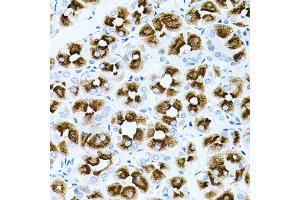 Immunohistochemistry of paraffin-embedded human stomach using DLK1 antibody (ABIN2562237) at dilution of 1:100 (40x lens). (DLK1 anticorps)