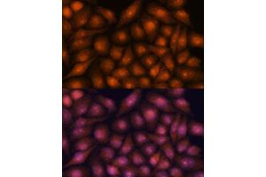 Immunofluorescence analysis of HeLa cells using DDX31 antibody (ABIN7266695) at dilution of 1:100.