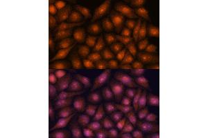 Immunofluorescence analysis of HeLa cells using DDX31 antibody (ABIN7266695) at dilution of 1:100. (DDX31 anticorps  (AA 652-851))