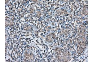 Immunohistochemical staining of paraffin-embedded Human Kidney tissue using anti-TBXAS1 mouse monoclonal antibody. (TBXAS1 anticorps)