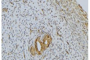 ABIN6276642 at 1/100 staining Human uterus tissue by IHC-P. (PRSS1 anticorps  (Internal Region))