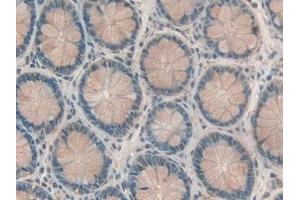 Detection of RBP2 in Human Rectum Tissue using Polyclonal Antibody to Retinol Binding Protein 2, Cellular (RBP2)