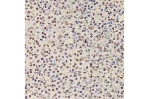 Immunohistochemistry of paraffin-embedded human amygdalitis using ANP32A Antibody.