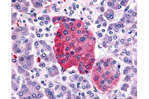 Anti-SSTR2 antibody IHC of human pancreas, islet of Langerhans.