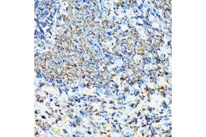 Immunohistochemistry of paraffin-embedded mouse spleen using CORO1A Rabbit pAb (ABIN6133495, ABIN6138903, ABIN6138904 and ABIN6224969) at dilution of 1:100 (40x lens). (Coronin 1a anticorps  (AA 362-461))