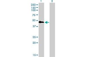 Western Blot analysis of TNFRSF19 expression in transfected 293T cell line by TNFRSF19 monoclonal antibody (M01), clone 2G4. (TNFRSF19 anticorps  (AA 30-119))