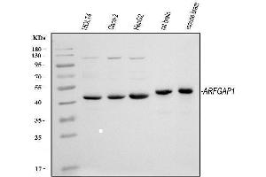Western blot analysis of ARFGAP1 using anti-ARFGAP1 antibody (ABIN4886474). (ARFGAP1 anticorps  (AA 1-183))