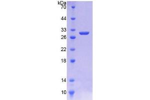 SDS-PAGE analysis of Rat HMGCR Protein. (HMGCR Protéine)