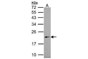 WB Image NDUFB5 antibody detects NDUFB5 protein by Western blot analysis.