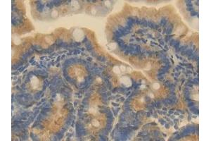 Detection of ESAM in Mouse Small intestine Tissue using Polyclonal Antibody to Endothelial Cell Adhesion Molecule (ESAM)